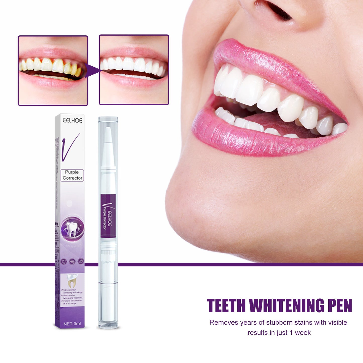 EELHOE Purple Smile Brightener
