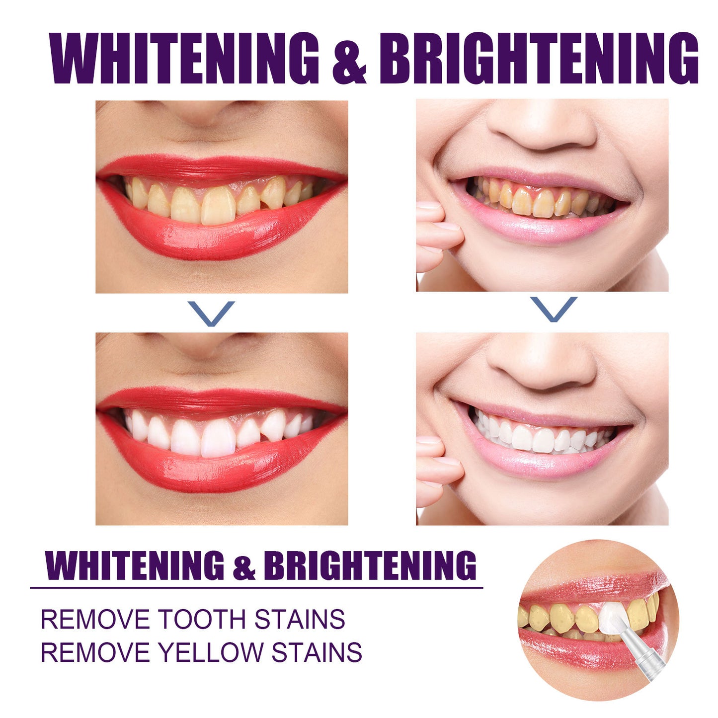 EELHOE Purple Smile Brightener