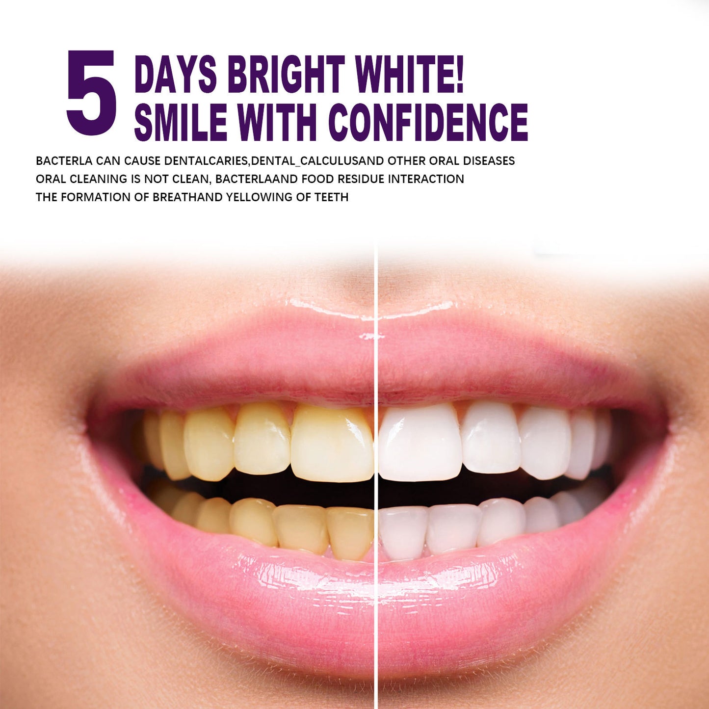 EELHOE Purple Smile Brightener