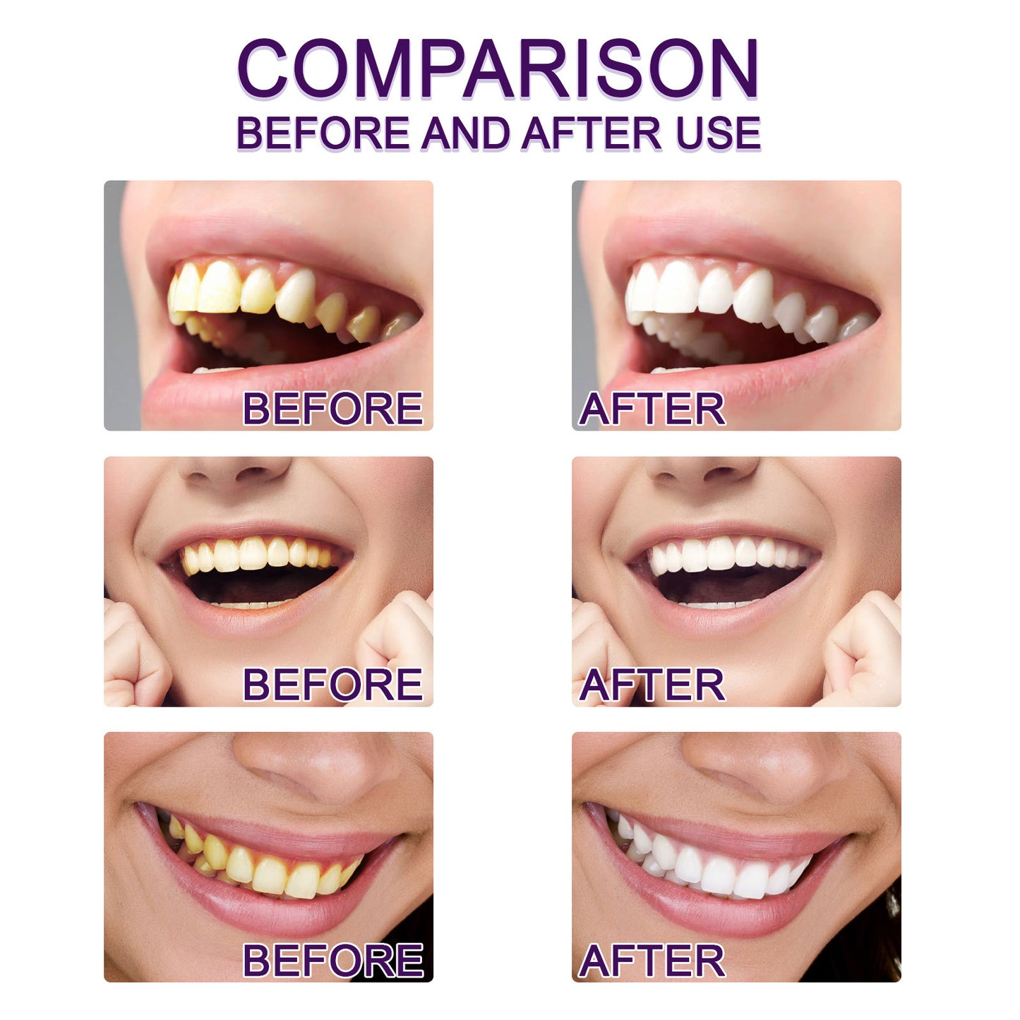EELHOE Purple Smile Brightener